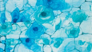 Cool-Fissure-Janet-Chaff
